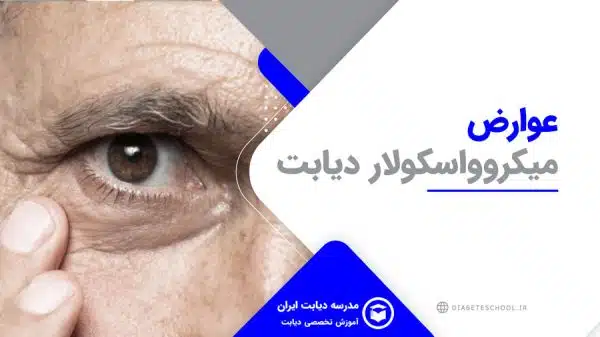 عوارض میکروواسکولار دیابت 